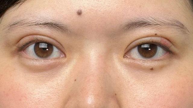 手术前的状态 其一