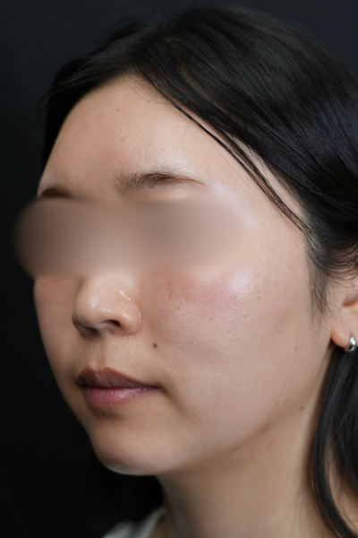 手術前の状態 その1