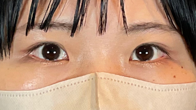 手术前的状态 其一