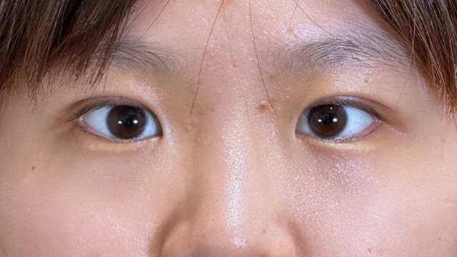 手术前的状态 其一