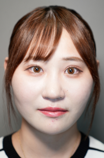 手术前的状态 其一