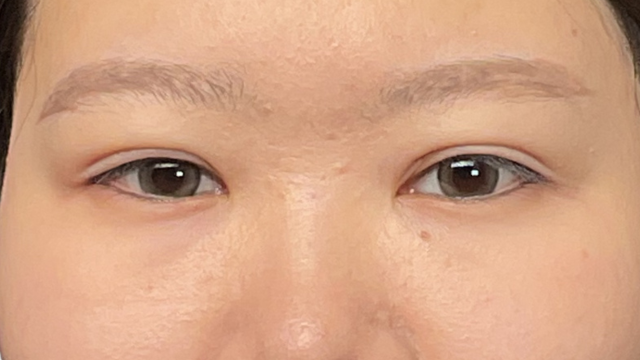 Postoperative Condition Part 1