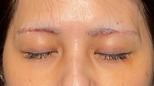 Postoperative Condition Part 1