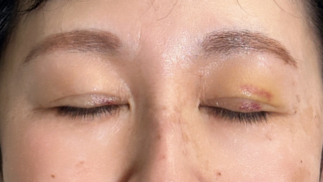 手术前的状态 其一