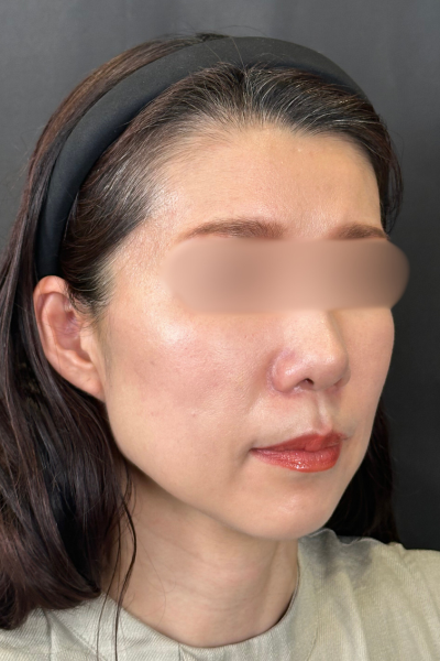 Postoperative Condition Part 1