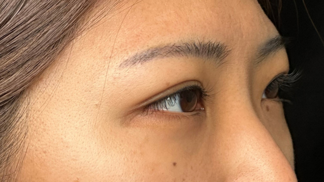 Postoperative Condition Part 1