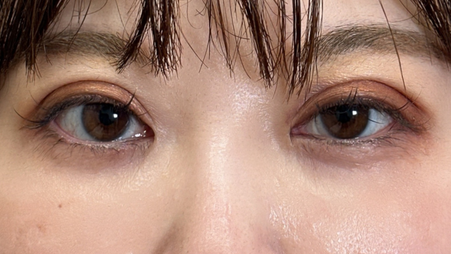 手术前的状态 其一