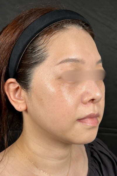 手術前の状態 その1