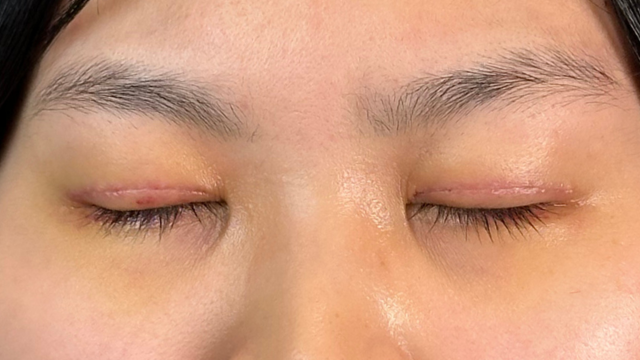 手术前的状态 其一