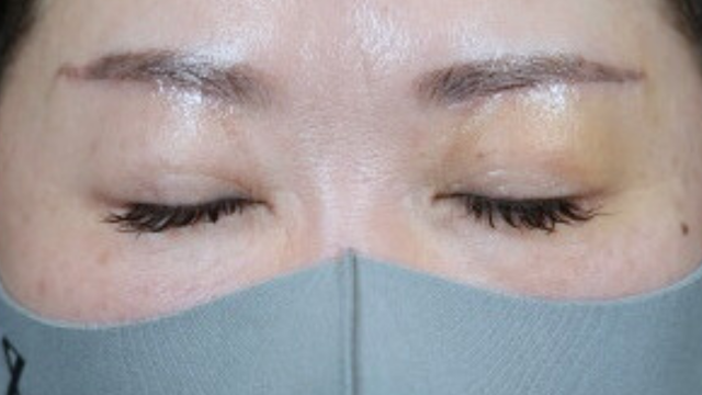 Postoperative Condition Part 1