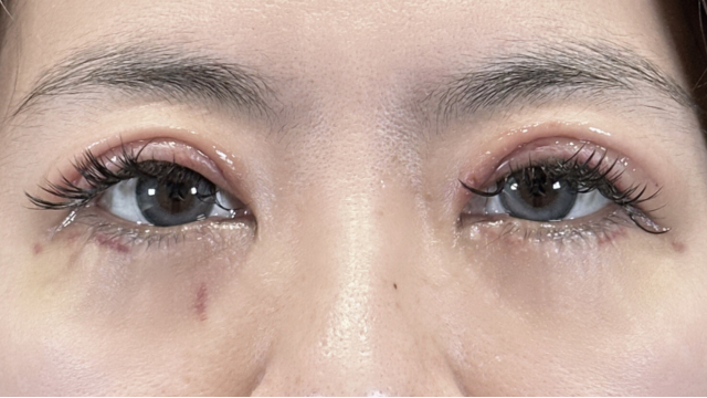 Postoperative Condition Part 1