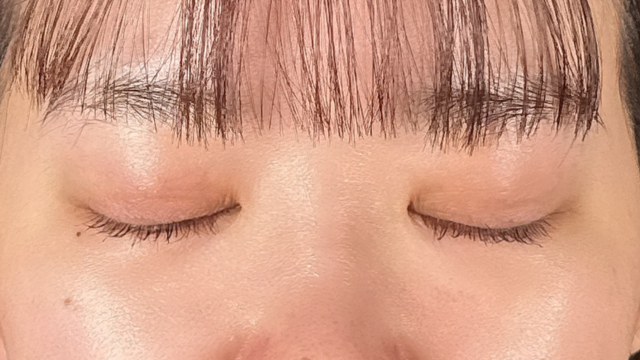 手术前的状态 其一