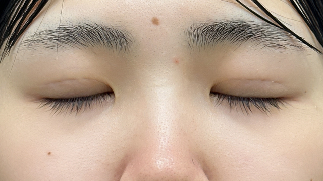 Postoperative Condition Part 1