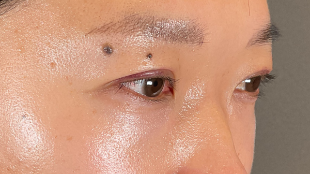 Postoperative Condition Part 1