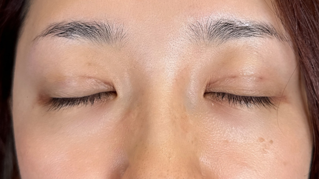 手术前的状态 其一