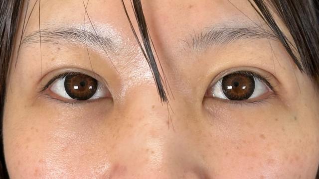 手术前的状态 其一