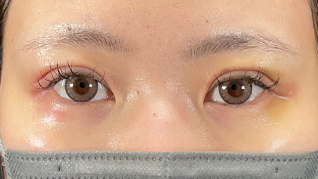 手术前的状态 其一