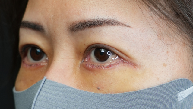 Postoperative Condition Part 1