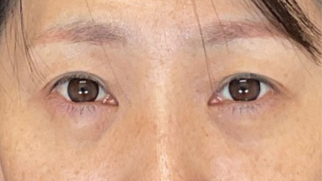 手术前的状态 其一