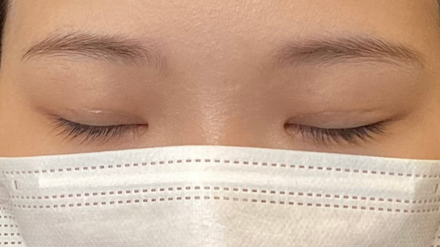 Postoperative Condition Part 1