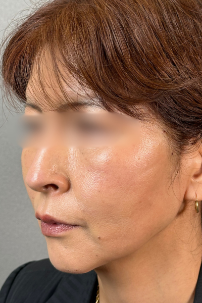 手術前の状態 その1