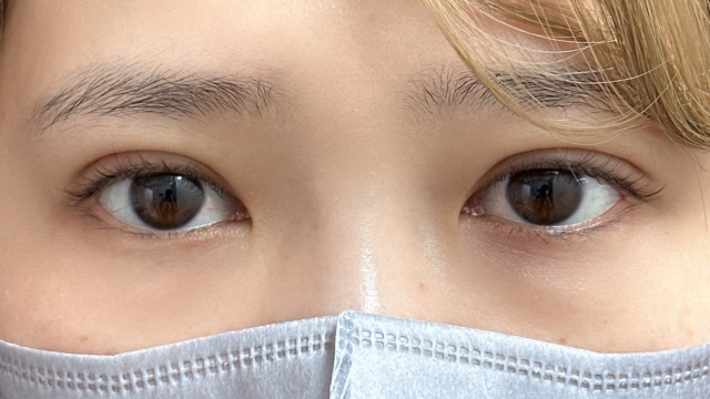 手术前的状态 其一