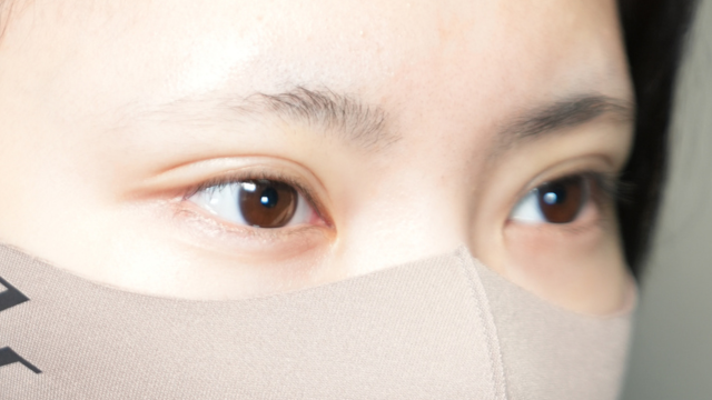 手术前的状态 其一