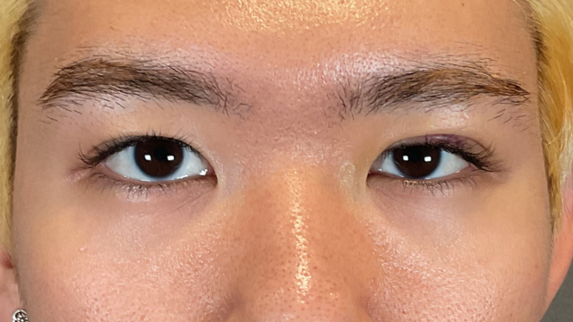 Postoperative Condition Part 1