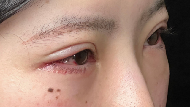 手術前の状態 その1