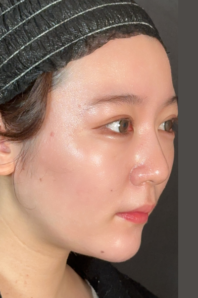 手術前の状態 その1