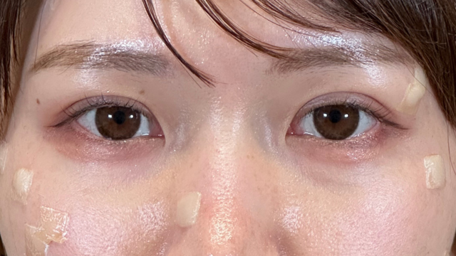 手术前的状态 其一