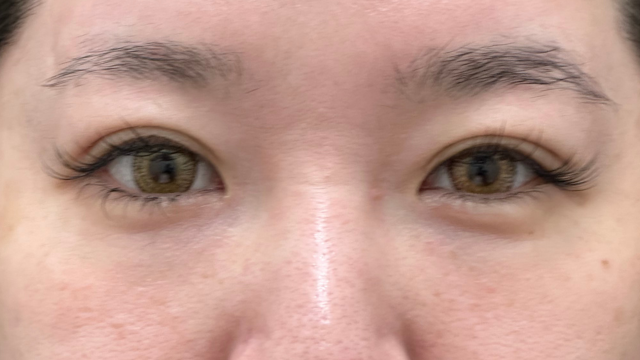 Postoperative Condition Part 1