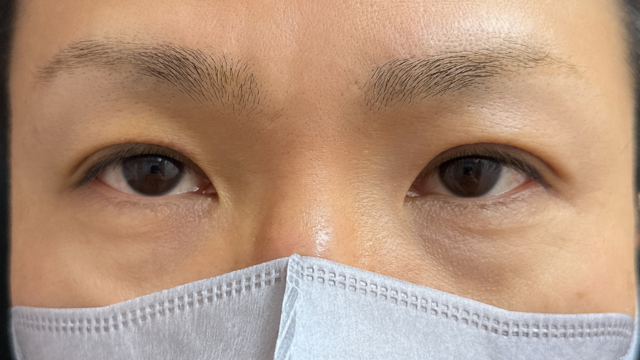 手术前的状态 其一