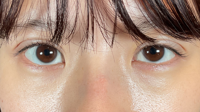 手术前的状态 其一