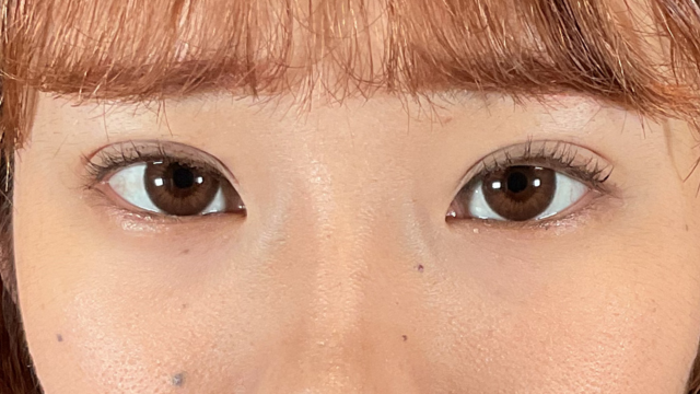 手术前的状态 其一