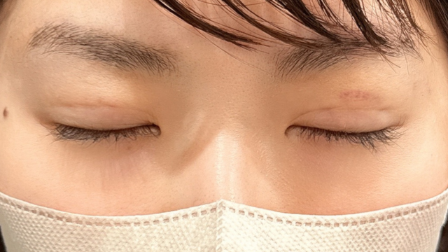 手术前的状态 其一