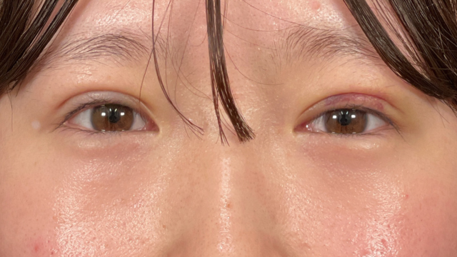 Postoperative Condition Part 1