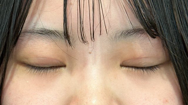 Postoperative Condition Part 1