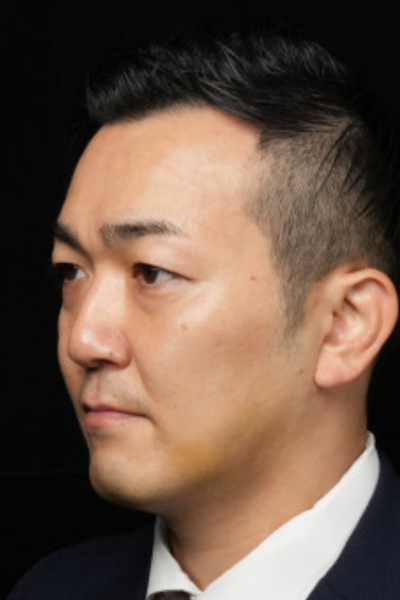 手術前の状態 その1