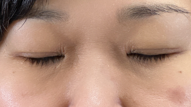 Postoperative Condition Part 1