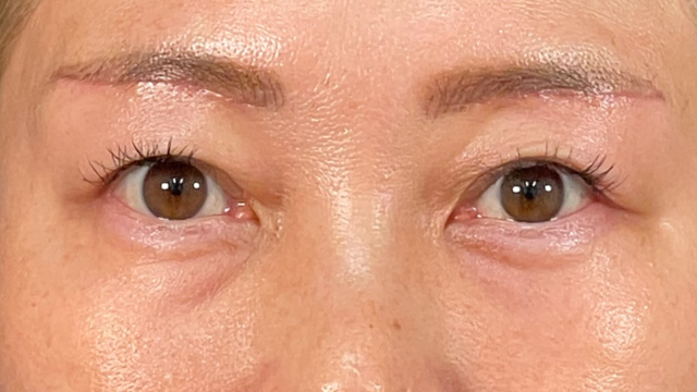 Postoperative Condition Part 1