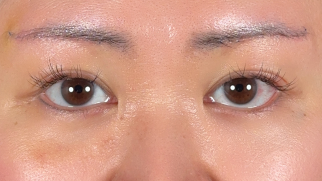 Postoperative Condition Part 1