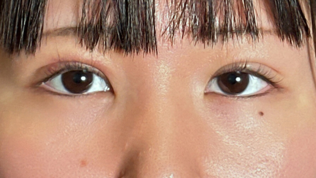 Postoperative Condition Part 1