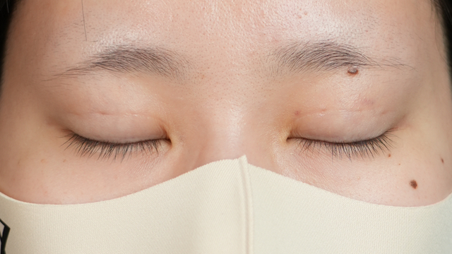 Postoperative Condition Part 1