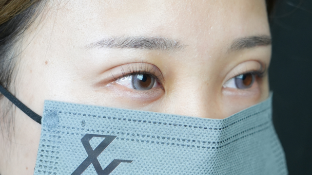 手術前の状態 その1