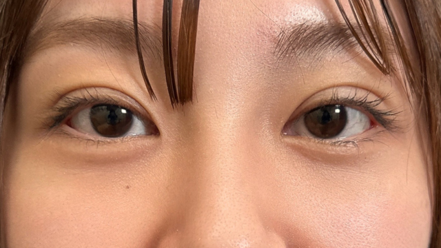 手术前的状态 其一