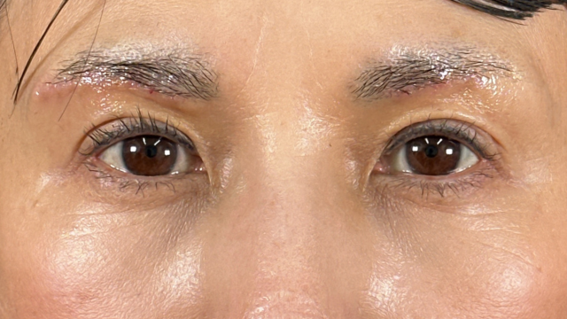 手術前の状態 その1