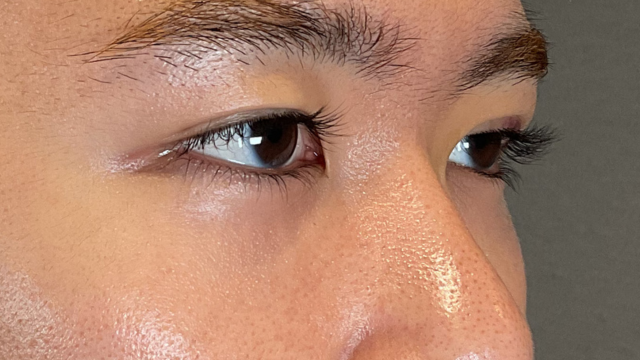 Postoperative Condition Part 1