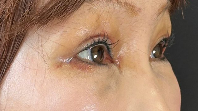 手术前的状态 其一