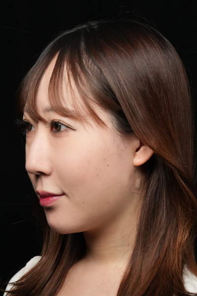 手術前の状態 その1